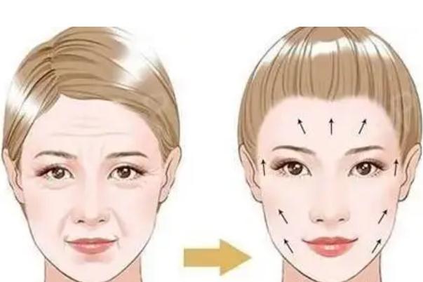 拉皮手術(shù)是拉的筋膜層還是皮膚層 拉皮手術(shù)是大手術(shù)嗎 拉皮手術(shù)是拉的筋膜層還是皮膚層 拉皮手術(shù)是大手術(shù)嗎