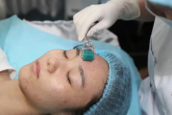 激光祛痘會留下痘坑嗎 激光祛痘會不會對皮膚有影響 激光祛痘會留下痘坑嗎 激光祛痘會不會對皮膚有影響