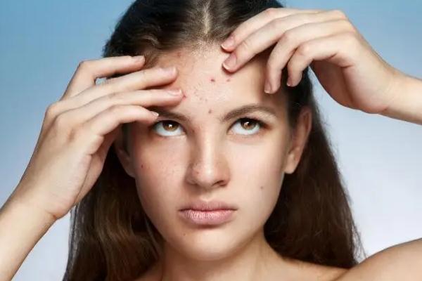 紅藍(lán)光祛痘的作用及副作用 紅藍(lán)光祛痘到底有沒有效果 紅藍(lán)光祛痘的作用及副作用 紅藍(lán)光祛痘到底有沒有效果