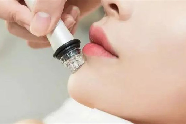 膠原蛋白填充粉真的有效果嗎 膠原蛋白填充粉的用法 膠原蛋白填充粉真的有效果嗎 膠原蛋白填充粉的用法