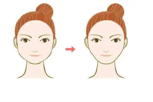 膠原蛋白填充粉真的有效果嗎 膠原蛋白填充粉的用法 膠原蛋白填充粉真的有效果嗎 膠原蛋白填充粉的用法