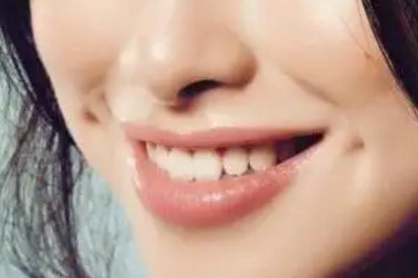 人造酒窩有點疼吃什么藥好 人造酒窩后如何消腫 人造酒窩有點疼吃什么藥好 人造酒窩后如何消腫