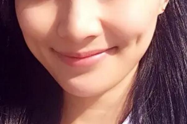 人造酒窩有后遺癥嗎 人造酒窩多久恢復(fù)自然 人造酒窩有后遺癥嗎 人造酒窩多久恢復(fù)自然