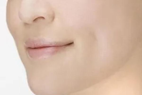 人造酒窩的價(jià)格 人造酒窩是不是一天比一天好 人造酒窩的價(jià)格 人造酒窩是不是一天比一天好