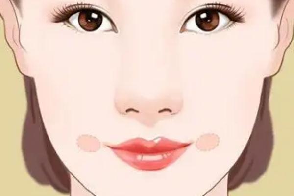 人造酒窩能保持多久 人造酒窩不笑會有窩嗎 人造酒窩能保持多久 人造酒窩不笑會有窩嗎