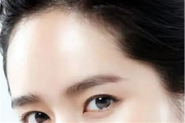 額頭填充一般填哪個(gè)部位 額頭填充用哪種玻尿酸好 額頭填充一般填哪個(gè)部位 額頭填充用哪種玻尿酸好