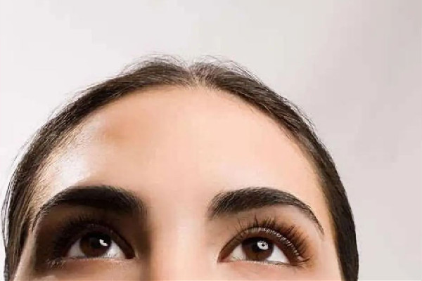 額頭填充是局麻還是全麻 額頭填充怎么做的 額頭填充是局麻還是全麻 額頭填充怎么做的