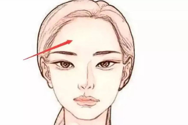 額頭填充玻尿酸需要幾支 額頭填充玻尿酸多久恢復(fù)正常 額頭填充玻尿酸需要幾支 額頭填充玻尿酸多久恢復(fù)正常