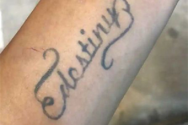 洗紋身會(huì)有增生疤痕嗎 洗紋身有點(diǎn)凸起來(lái)正常嗎 洗紋身會(huì)有增生疤痕嗎 洗紋身有點(diǎn)凸起來(lái)正常嗎