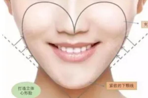 蘋果肌復(fù)位術(shù)多少錢 蘋果肌復(fù)位最好的辦法 蘋果肌復(fù)位術(shù)多少錢 蘋果肌復(fù)位最好的辦法