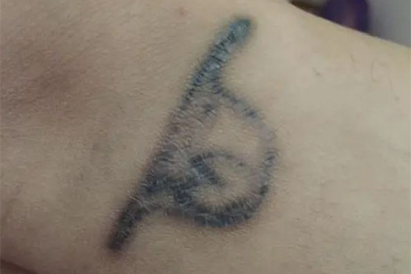 洗紋身敷麻藥嗎 洗紋身敷麻藥對人體有沒有傷害 洗紋身敷麻藥嗎 洗紋身敷麻藥對人體有沒有傷害