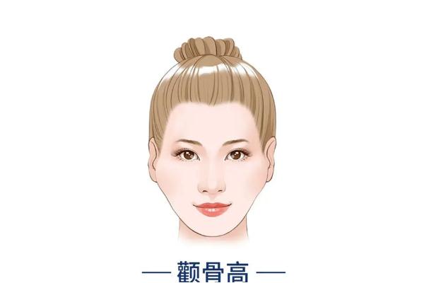 顴骨內推要開刀嗎 顴骨內推有生命危險嗎 顴骨內推要開刀嗎 顴骨內推有生命危險嗎