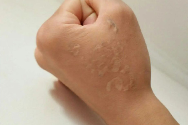 洗紋身會(huì)不會(huì)很疼 洗紋身什么感覺 洗紋身會(huì)不會(huì)很疼 洗紋身什么感覺