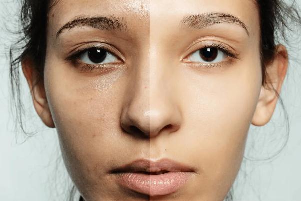 皮膚暗黃怎么改善變白 皮膚暗黃如何調(diào)理 皮膚暗黃怎么改善變白 皮膚暗黃如何調(diào)理