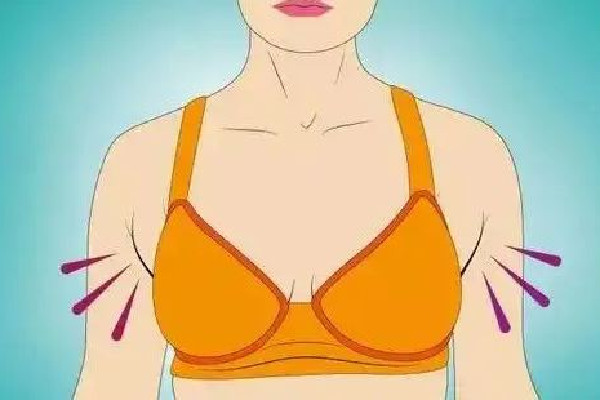 副乳切除手術(shù)會(huì)有疤痕嗎 副乳切除手術(shù)怎么才能看不到疤痕 副乳切除手術(shù)會(huì)有疤痕嗎 副乳切除手術(shù)怎么才能看不到疤痕