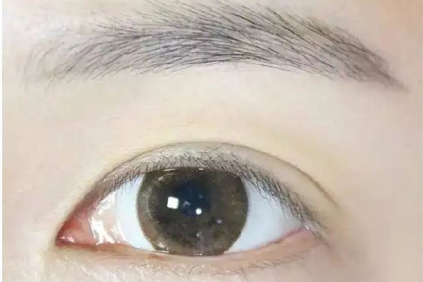 刮眉毛后有點痛怎么辦 刮眉毛后怎么護理 刮眉毛后有點痛怎么辦 刮眉毛后怎么護理