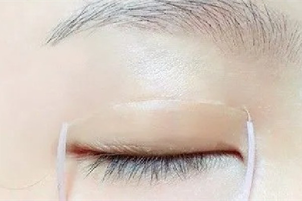 雙眼皮貼直接撕會怎樣 雙眼皮貼怎么取下來 雙眼皮貼直接撕會怎樣 雙眼皮貼怎么取下來