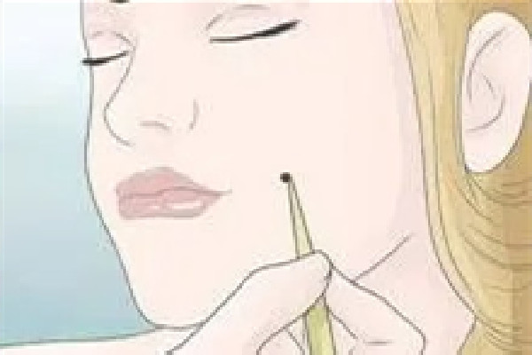 武漢點痣哪家醫(yī)院好 武漢點痣?yún)f(xié)和好還是同濟好 武漢點痣哪家醫(yī)院好 武漢點痣?yún)f(xié)和好還是同濟好