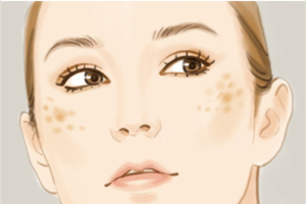 武漢祛斑最好醫(yī)院排名 武漢祛斑可以用醫(yī)保嗎 武漢祛斑最好醫(yī)院排名 武漢祛斑可以用醫(yī)保嗎