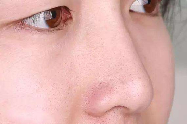 去黑頭在面膜前還是后 去黑頭什么時候時間去好 去黑頭在面膜前還是后 去黑頭什么時候時間去好