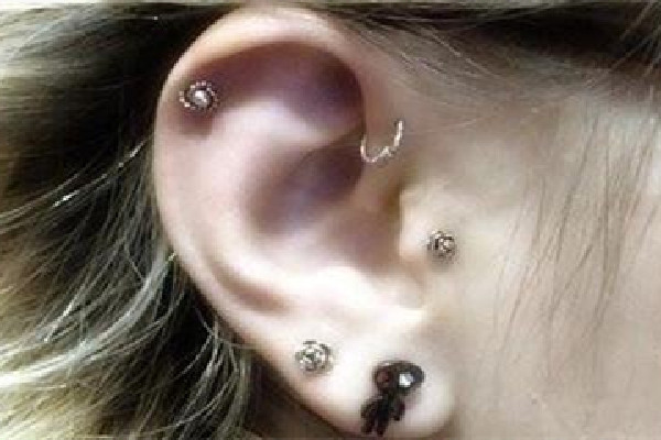 武漢市中心醫(yī)院可以打耳洞嗎 武漢激光打耳洞多少錢 武漢市中心醫(yī)院可以打耳洞嗎 武漢激光打耳洞多少錢