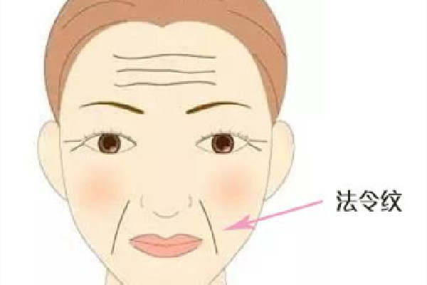 武漢去法令紋哪里好 武漢哪里可以去掉脂肪粒 武漢去法令紋哪里好 武漢哪里可以去掉脂肪粒