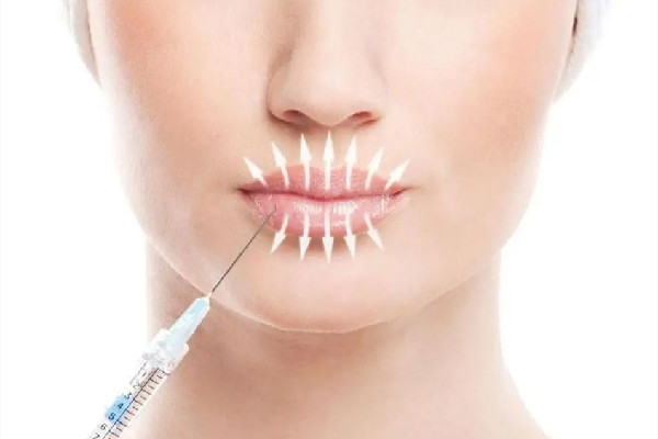 武漢豐唇哪個醫(yī)院自然 武漢豐唇多少錢 武漢豐唇哪個醫(yī)院自然 武漢豐唇多少錢