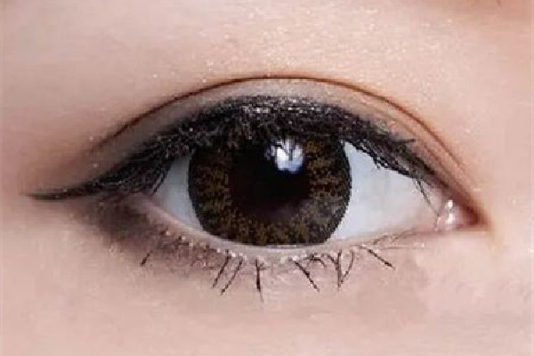 武漢埋線(xiàn)雙眼皮哪家做的好 武漢三甲醫(yī)院埋線(xiàn)雙眼皮多少錢(qián)