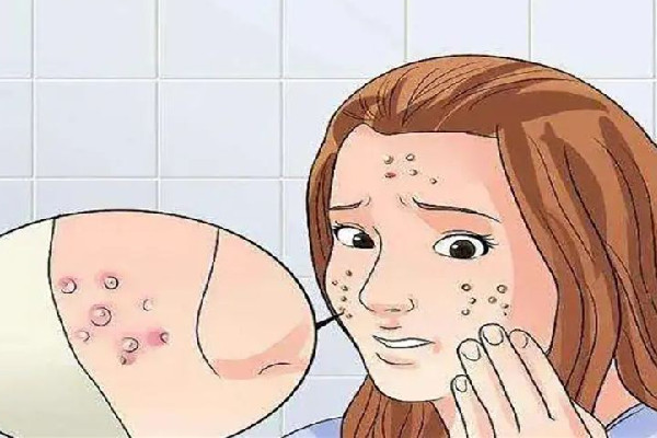 武漢去痘坑醫(yī)院哪家好 武漢去痘坑修復(fù)凹洞手術(shù)多少錢 武漢去痘坑醫(yī)院哪家好 武漢去痘坑修復(fù)凹洞手術(shù)多少錢