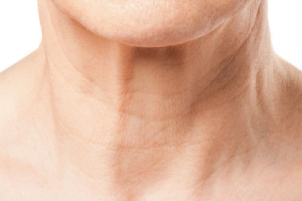 武漢嗨體去頸紋多少錢 武漢去頸紋好的醫(yī)院 武漢嗨體去頸紋多少錢 武漢去頸紋好的醫(yī)院