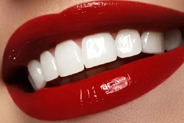 武漢美白牙齒去哪里好 武漢美白牙齒多少錢 武漢美白牙齒去哪里好 武漢美白牙齒多少錢