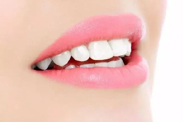 武漢美白牙齒去哪里好 武漢美白牙齒多少錢 武漢美白牙齒去哪里好 武漢美白牙齒多少錢