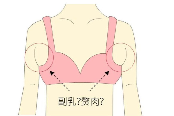 武漢切副乳哪個醫(yī)院好 武漢副乳切除手術去哪家三甲醫(yī)院