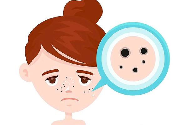 武漢超皮秒在哪里做比較好 武漢超皮秒祛斑大概多少錢一次 武漢超皮秒在哪里做比較好 武漢超皮秒祛斑大概多少錢一次