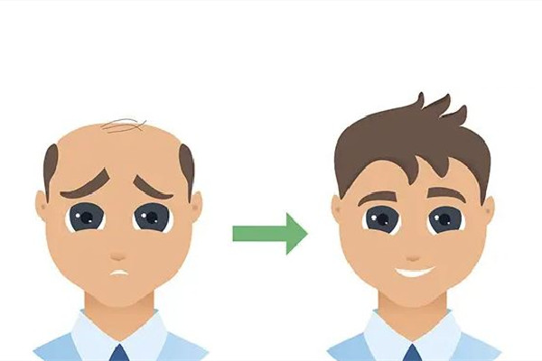 武漢植發(fā)醫(yī)院哪家好 武漢植發(fā)要多少錢(qián) 武漢植發(fā)醫(yī)院哪家好 武漢植發(fā)要多少錢(qián)