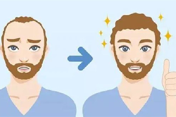 武漢發(fā)際線種植比較好的醫(yī)院 武漢發(fā)際線整形價(jià)格 武漢發(fā)際線種植比較好的醫(yī)院 武漢發(fā)際線整形價(jià)格