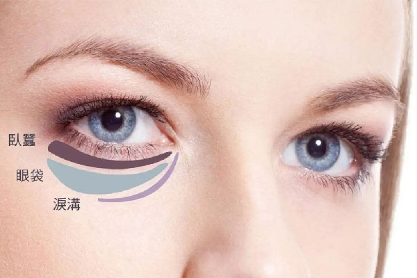 武漢激光去眼袋價格 武漢激光去眼袋哪家好 武漢激光去眼袋價格 武漢激光去眼袋哪家好