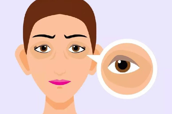 武漢哪家醫(yī)院眼袋手術(shù)做的好 武漢做眼袋手術(shù)價(jià)格 武漢哪家醫(yī)院眼袋手術(shù)做的好 武漢做眼袋手術(shù)價(jià)格