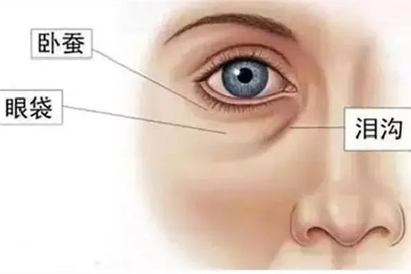 武漢哪家醫(yī)院去淚溝效果好 武漢去淚溝要花多少錢 武漢哪家醫(yī)院去淚溝效果好 武漢去淚溝要花多少錢