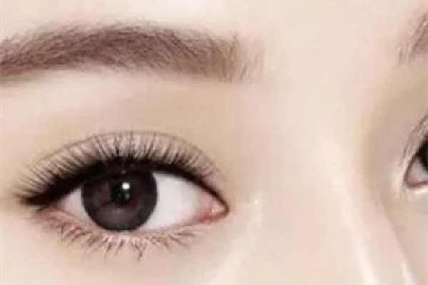 武漢雙眼皮修復手術哪里做的比較好 武漢雙眼皮修復價格表 武漢雙眼皮修復手術哪里做的比較好 武漢雙眼皮修復價格表