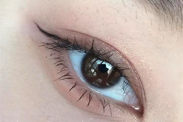 武漢豐臥蠶哪家醫(yī)院好 武漢做臥蠶大概多少錢 武漢豐臥蠶哪家醫(yī)院好 武漢做臥蠶大概多少錢