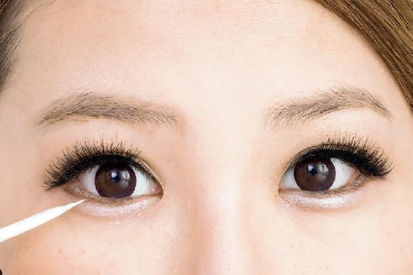 武漢填充臥蠶哪家好 武漢臥蠶手術(shù)哪個(gè)醫(yī)院做的好 武漢填充臥蠶哪家好 武漢臥蠶手術(shù)哪個(gè)醫(yī)院做的好