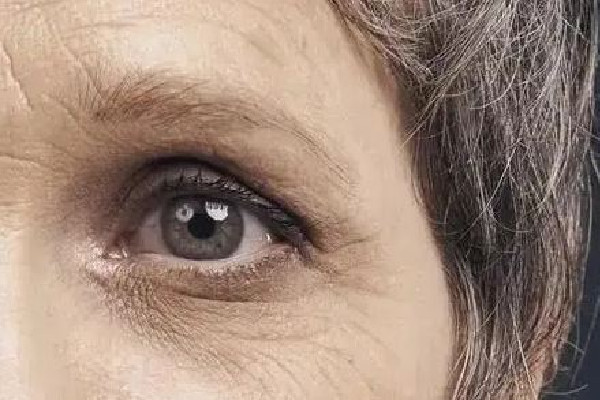 武漢可以做眼部松弛的醫(yī)院 武漢做眼部松弛價格 武漢可以做眼部松弛的醫(yī)院 武漢做眼部松弛價格