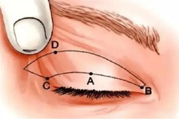 武漢上眼瞼下垂哪個醫(yī)院做的好 武漢上眼瞼下垂修復(fù)手術(shù)要多少錢 武漢上眼瞼下垂哪個醫(yī)院做的好 武漢上眼瞼下垂修復(fù)手術(shù)要多少錢