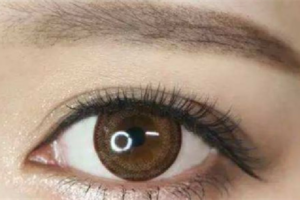 武漢去哪做三角眼矯正好 武漢做三角眼矯正費用 武漢去哪做三角眼矯正好 武漢做三角眼矯正費用