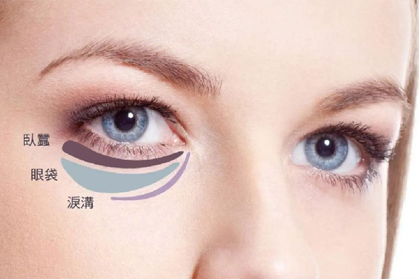 武漢下眼袋摘除手術(shù)多少錢 武漢下眼袋摘除手術(shù)醫(yī)院 武漢下眼袋摘除手術(shù)多少錢 武漢下眼袋摘除手術(shù)醫(yī)院