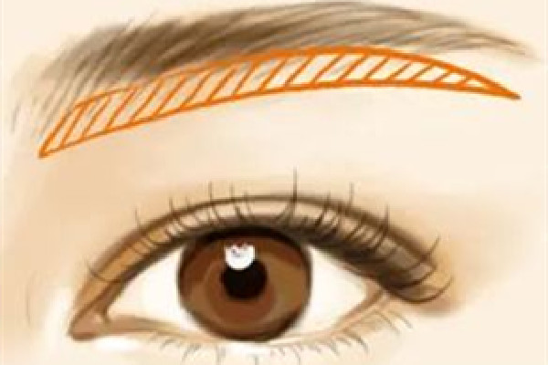 武漢做眉弓手術(shù)多少錢 武漢做眉弓手術(shù)去哪家醫(yī)院 武漢做眉弓手術(shù)多少錢 武漢做眉弓手術(shù)去哪家醫(yī)院