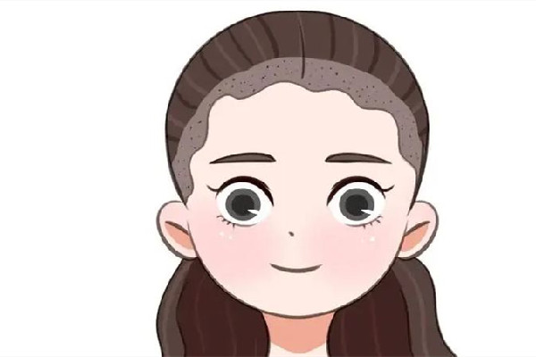 武漢脫發(fā)際線哪家機構好 武漢脫發(fā)際線哪里效果好