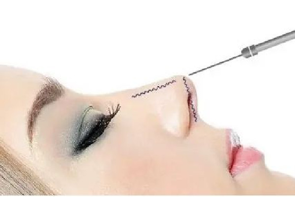 武漢假體隆鼻哪里好 武漢假體隆鼻費用 武漢假體隆鼻哪里好 武漢假體隆鼻費用