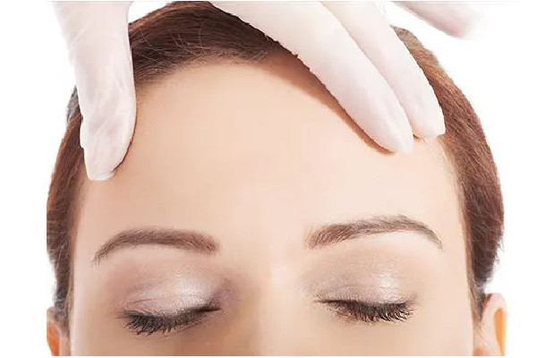 武漢額頭整形多少錢 武漢額頭整形去哪里好 武漢額頭整形多少錢 武漢額頭整形去哪里好